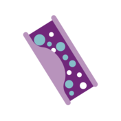 Blockages within arteries