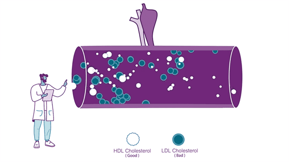 Image showing HDL Cholesterol (good) and LDL Cholesterol (bad)